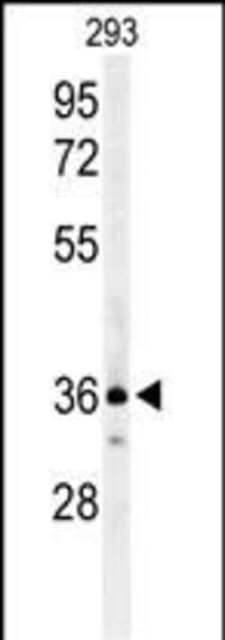 Invitrogen CCR1 Polyclonal Antibody 400 &mu;L; Unconjugated:Anticuerpos