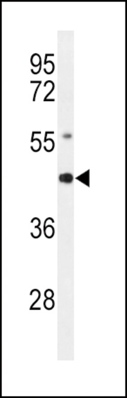 Invitrogen RAGE Polyclonal Antibody 400 &mu;L; Unconjugated:Antibodies,