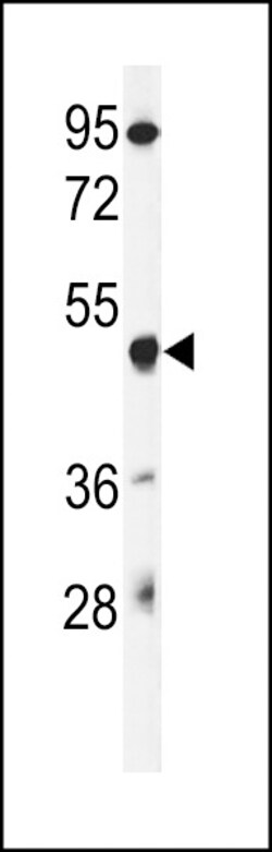 Invitrogen GSDMA Polyclonal Antibody 400 &mu;L; Unconjugated:Antibodies,