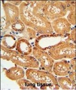 Invitrogen COQ9 Polyclonal Antibody 400 &mu;L; Unconjugated:Antibodies,
