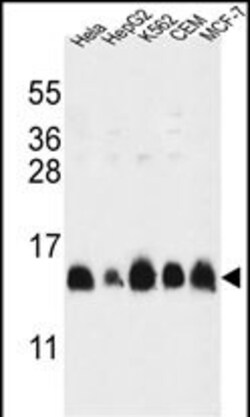 Invitrogen HIST1H2AG Polyclonal Antibody 400 &mu;L; Unconjugated:Antibodies,
