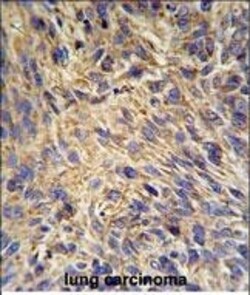 Invitrogen GRP94 Polyclonal Antibody 400 &mu;L; Unconjugated:Antibodies,