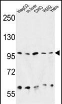 Invitrogen GRP94 Polyclonal Antibody 400 &mu;L; Unconjugated:Antibodies,