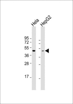 Invitrogen Opsin Green Polyclonal Antibody 400 &mu;L; Unconjugated:Antibodies,