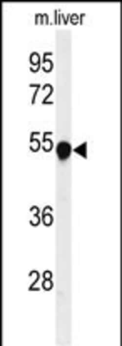 Invitrogen PAH Polyclonal Antibody 400 &mu;L | Buy Online | Invitrogen&trade; | Fisher Scientific