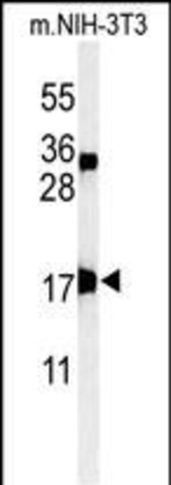 Invitrogen APITD1 Polyclonal Antibody 400 &mu;L; Unconjugated:Antibodies,