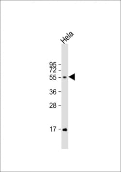 Invitrogen FUT6 Polyclonal Antibody 400 &mu;L; Unconjugated:Antibodies,
