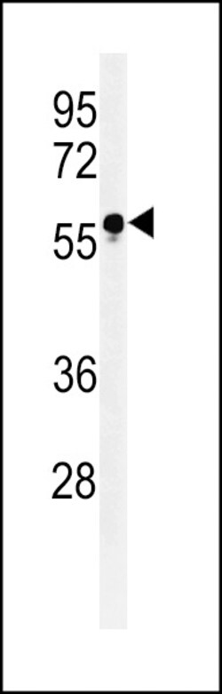 Invitrogen FUT6 Polyclonal Antibody 400 &mu;L; Unconjugated:Antibodies,