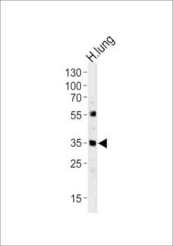 Invitrogen MFAP4 Polyclonal Antibody 400 &mu;L; Unconjugated:Anticuerpos