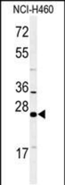 Invitrogen RAB27B Polyclonal Antibody 400 &mu;L; Unconjugated:Antibodies,