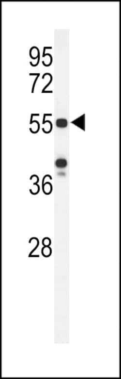 Invitrogen POTEH Polyclonal Antibody 400 &mu;L; Unconjugated:Antibodies,