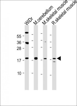 Invitrogen TPPP3 Polyclonal Antibody 400 &mu;L; Unconjugated:Antibodies,