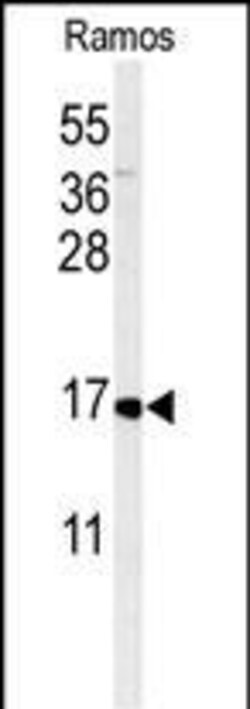 Invitrogen CMTM7 Polyclonal Antibody 400 μL; Unconjugated:Antibodies,