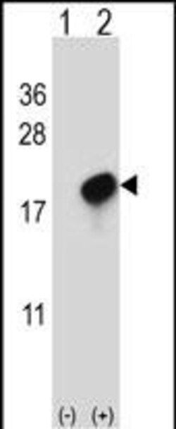 Invitrogen CMTM7 Polyclonal Antibody 400 μL; Unconjugated:Antibodies,