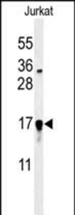 Invitrogen GLRX5 Polyclonal Antibody 400 &mu;L; Unconjugated:Antibodies,
