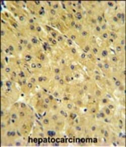 Invitrogen PSMAL Polyclonal Antibody 400 μL; Unconjugated:Antibodies,