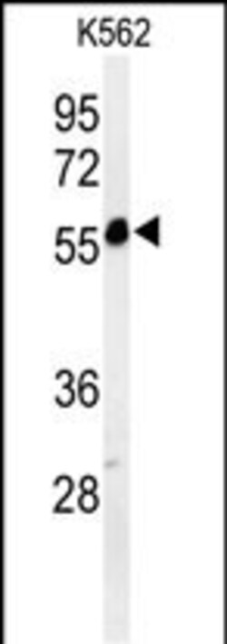 Invitrogen PSMAL Polyclonal Antibody 400 μL; Unconjugated:Antibodies,
