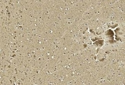Invitrogen S100B Polyclonal Antibody 400 &mu;L; Unconjugated:Antibodies,