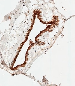 Invitrogen S100B Polyclonal Antibody 400 &mu;L; Unconjugated:Antibodies,