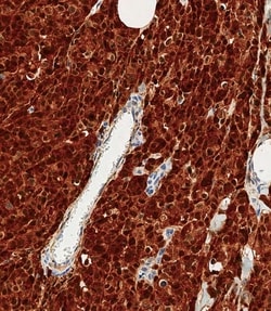 Invitrogen S100B Polyclonal Antibody 400 &mu;L; Unconjugated:Antibodies,