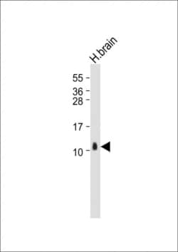 Invitrogen S100B Polyclonal Antibody 400 &mu;L; Unconjugated:Antibodies,