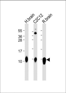 Invitrogen S100B Polyclonal Antibody 400 &mu;L; Unconjugated:Antibodies,
