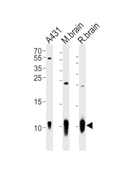 Invitrogen S100B Polyclonal Antibody 400 &mu;L; Unconjugated:Antibodies,