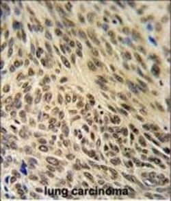 Invitrogen Ku70 Polyclonal Antibody 400 &mu;L; Unconjugated:Antibodies,
