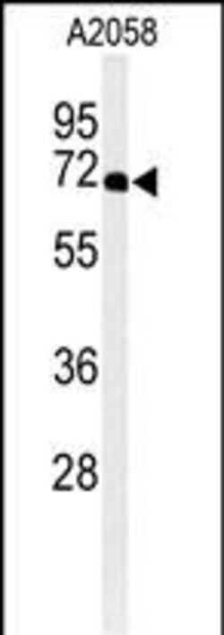 Invitrogen Ku70 Polyclonal Antibody 400 &mu;L; Unconjugated:Antibodies,