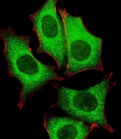 Invitrogen GLD2 Polyclonal Antibody 400 &mu;L; Unconjugated:Antibodies,
