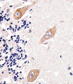 Invitrogen GLD2 Polyclonal Antibody 400 &mu;L; Unconjugated:Antibodies,