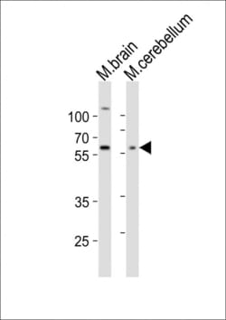 Invitrogen GLD2 Polyclonal Antibody 400 &mu;L; Unconjugated:Antibodies,