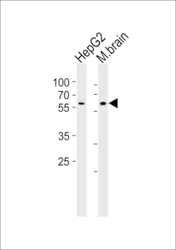 Invitrogen GLD2 Polyclonal Antibody 400 &mu;L; Unconjugated:Antibodies,