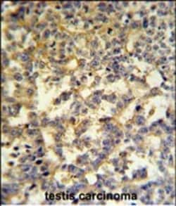 Invitrogen G6PD Polyclonal Antibody 400 &mu;L; Unconjugated:Antibodies,