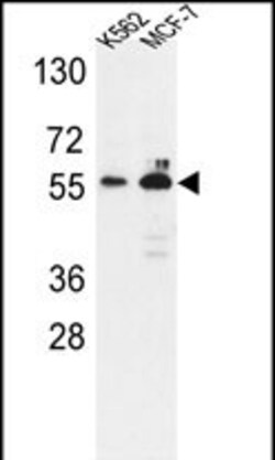 Invitrogen G6PD Polyclonal Antibody 400 &mu;L; Unconjugated:Antibodies,