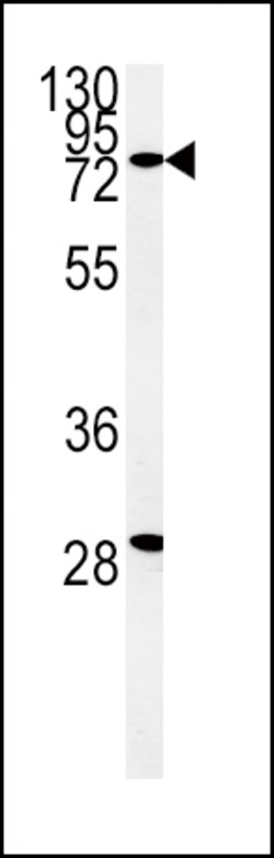 Invitrogen ZFYVE16 Polyclonal Antibody 400 &mu;L; Unconjugated:Antibodies,