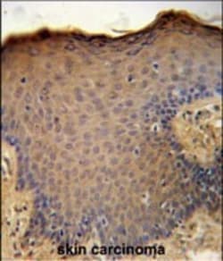 Invitrogen CXCL9 Polyclonal Antibody 400 &mu;L; Unconjugated:Antibodies,