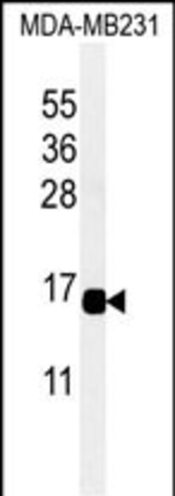 Invitrogen CXCL9 Polyclonal Antibody 400 &mu;L; Unconjugated:Antibodies,