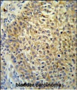Invitrogen TMEM222 Polyclonal Antibody 400 &mu;L; Unconjugated:Antibodies,