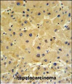 Invitrogen IFT20 Polyclonal Antibody 400 &mu;L; Unconjugated:Antibodies,