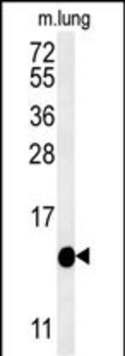 Invitrogen IFT20 Polyclonal Antibody 400 &mu;L; Unconjugated:Antibodies,
