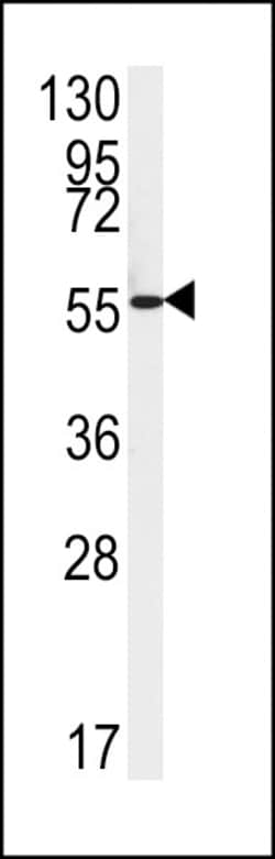Invitrogen FAAH2 Polyclonal Antibody 400 &mu;L; Unconjugated:Antibodies,