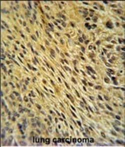Invitrogen CCDC62 Polyclonal Antibody 400 μL; Unconjugated:Antibodies,