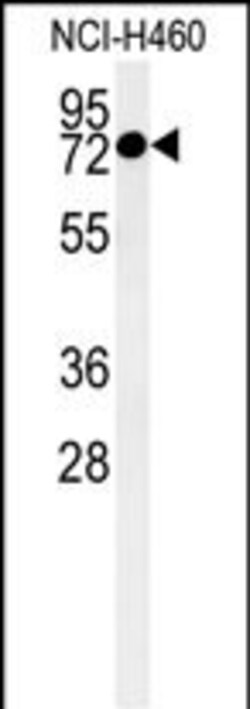 Invitrogen CCDC62 Polyclonal Antibody 400 μL; Unconjugated:Antibodies,