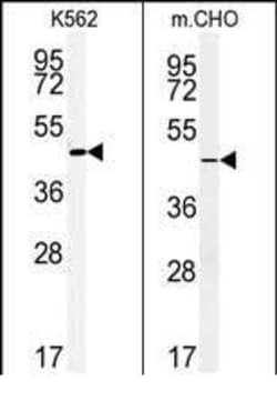 Invitrogen ENTPD8 Polyclonal Antibody 400 &mu;L; Unconjugated:Antibodies,