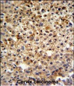 Invitrogen KIAA1529 Polyclonal Antibody 400 &mu;L | Buy Online | Invitrogen&trade; | Fisher Scientific