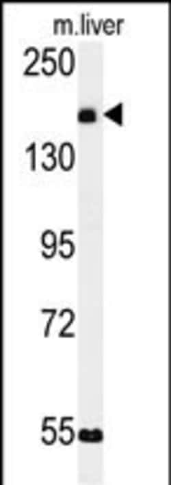 Invitrogen KIAA1529 Polyclonal Antibody 400 &mu;L | Buy Online | Invitrogen&trade; | Fisher Scientific