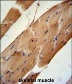 Invitrogen CNOT6L Polyclonal Antibody 400 &mu;L; Unconjugated:Antibodies,