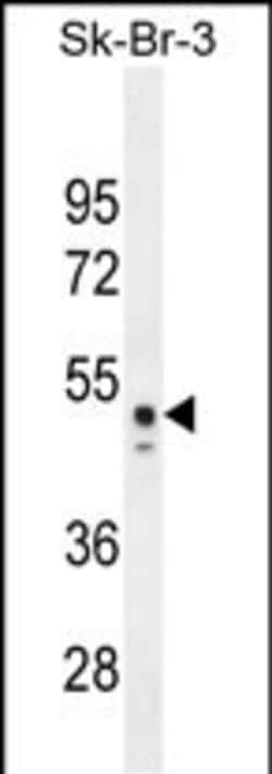 Invitrogen CNOT6L Polyclonal Antibody 400 &mu;L; Unconjugated:Antibodies,
