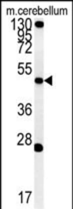 Invitrogen ENPP6 Polyclonal Antibody 400 &mu;L; Unconjugated:Antibodies,